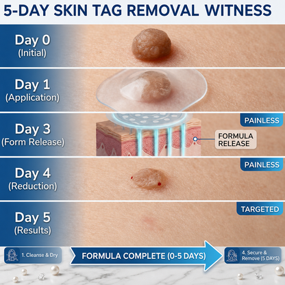 HISKIN® 2-in-1 Microneedle Hydrocolloid Patches | Helps Improve Raised Moles, Acne, Flat Warts & Skin Tags | Targets Fine Lines, Scars & Skin Imperfections | Invisible Face & Body Blemish Patches