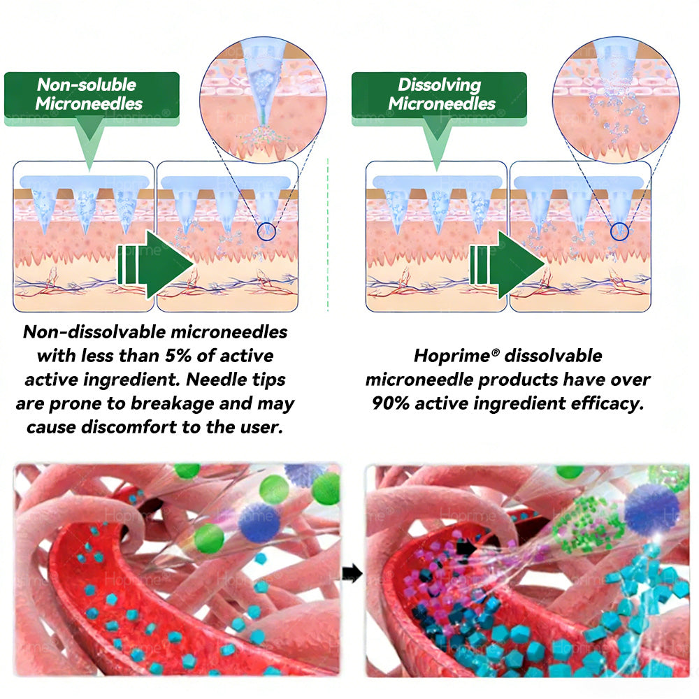 𝑶𝒇𝒇𝒊𝒄𝒊𝒂𝒍 𝑺𝒕𝒐𝒓𝒆 | ✨✨𝑯𝙤𝒑𝐫𝒊𝙢𝒆®𝑴𝒐𝒓𝒊𝒏𝒈𝗮 · 𝗕𝗲𝗿𝗯𝗲𝗿𝙞𝙣𝙚 × 𝙉𝘼𝐃+ 𝟏𝟎-𝐢𝐧-𝟏 𝗔𝗱𝘃𝗮𝗻𝗰𝙚𝙙 𝙉ano 𝙈𝙞𝙘𝙧𝙤𝙣𝙚𝙚𝐝𝐥𝐞 𝐏𝐚𝐭𝙘𝙝🇺🇸(𝐉𝐮𝐬𝐭 𝐨𝐧𝐜𝐞 𝐚 𝐝𝐚𝐲, 𝐯𝐢𝐬𝐢𝐛𝐥𝐞 𝐜𝐡𝐚𝐧𝐠𝐞𝐬 𝐢𝐧 𝟕 𝐝𝐚𝐲𝐬） ✅ 𝐅𝐨𝐫 𝐨𝐛𝐞𝐬𝐢𝐭𝐲, 🅛🅞🅞🅢🅔 🅢🅚🅘🅝,𝐝𝐢𝐚𝐛𝐞𝐭𝐞𝐬, 𝐬𝐥𝐞𝐞𝐩 𝐚𝐩𝐧𝐞𝐚, 𝐣𝐨𝐢𝐧𝐭 𝐢𝐬𝐬𝐮𝐞𝐬, 𝐚𝐧𝐝 𝐦𝐨𝐫𝐞
