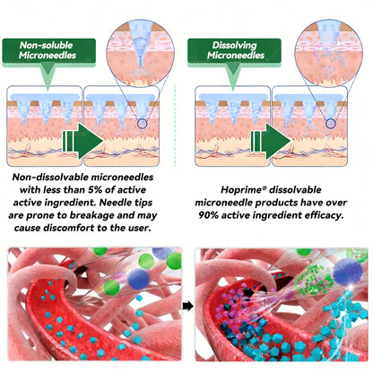 𝑶𝒇𝒇𝒊𝒄𝒊𝒂𝒍 𝑺𝒕𝒐𝒓𝒆 | ✨✨𝑯𝙤𝒑𝐫𝒊𝙢𝒆®𝑴𝒐𝒓𝒊𝒏𝒈𝗮 · 𝗕𝗲𝗿𝗯𝗲𝗿𝙞𝙣𝙚 × 𝙉𝘼𝐃+ 𝟏𝟎-𝐢𝐧-𝟏 𝗔𝗱𝘃𝗮𝗻𝗰𝙚𝙙 𝙉ano 𝙈𝙞𝙘𝙧𝙤𝙣𝙚𝙚𝐝𝐥𝐞 𝐏𝐚𝐭𝙘𝙝🇺🇸(𝐉𝐮𝐬𝐭 𝐨𝐧𝐜𝐞 𝐚 𝐝𝐚𝐲, 𝐯𝐢𝐬𝐢𝐛𝐥𝐞 𝐜𝐡𝐚𝐧𝐠𝐞𝐬 𝐢𝐧 𝟕 𝐝𝐚𝐲𝐬） ✅ 𝐅𝐨𝐫 𝐨𝐛𝐞𝐬𝐢𝐭𝐲, 🅛🅞🅞🅢🅔 🅢🅚🅘🅝,𝐝𝐢𝐚𝐛𝐞𝐭𝐞𝐬, 𝐬𝐥𝐞𝐞𝐩 𝐚𝐩𝐧𝐞𝐚, 𝐣𝐨𝐢𝐧𝐭 𝐢𝐬𝐬𝐮𝐞𝐬, 𝐚𝐧𝐝 𝐦𝐨𝐫𝐞
