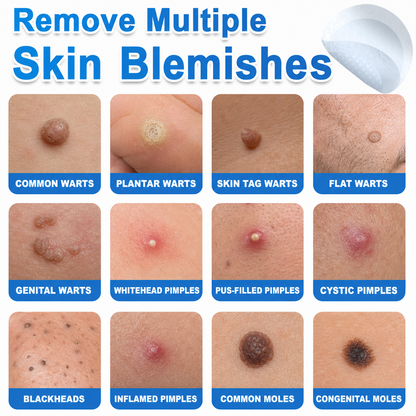 HISKIN® 2-in-1 Microneedle Hydrocolloid Patches | Helps Improve Raised Moles, Acne, Flat Warts & Skin Tags | Targets Fine Lines, Scars & Skin Imperfections | Invisible Face & Body Blemish Patches