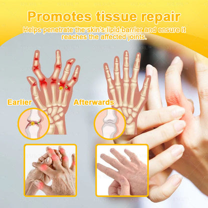 XRLXRL® Bee Venom Pain-Relief Bone Healing Cream ⏰(Specially for older adults)