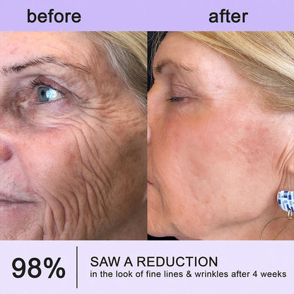 Himilk® Bee Venom & Botox Wrinkle-Lift Tightening Cream 🐝 (Anti-Aging,Hydration, Skin Repair, Acne & Dark Spot Treatment, Wart & Mole Removal, Psoriasis Relief) 🌸