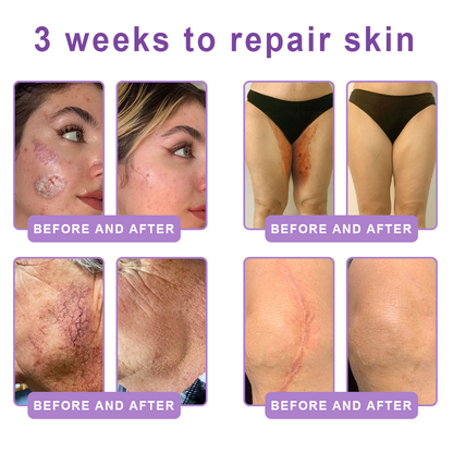HISKIN® ---Only 10 boxes! Grab an exclusive 30% discount now! Keep your skin youthful and glowing in just 1 to 3 weeks. Don’t miss your chance—this offer won’t come around again until next year. Act fast! 180-day money back guarantee!🔥