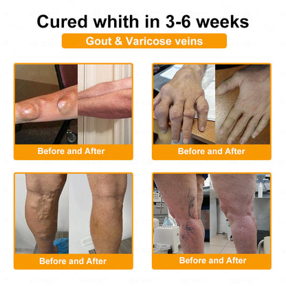XRLXRL® Bee Venom Pain-Relief Bone Healing Cream ⏰(Specially for older adults)