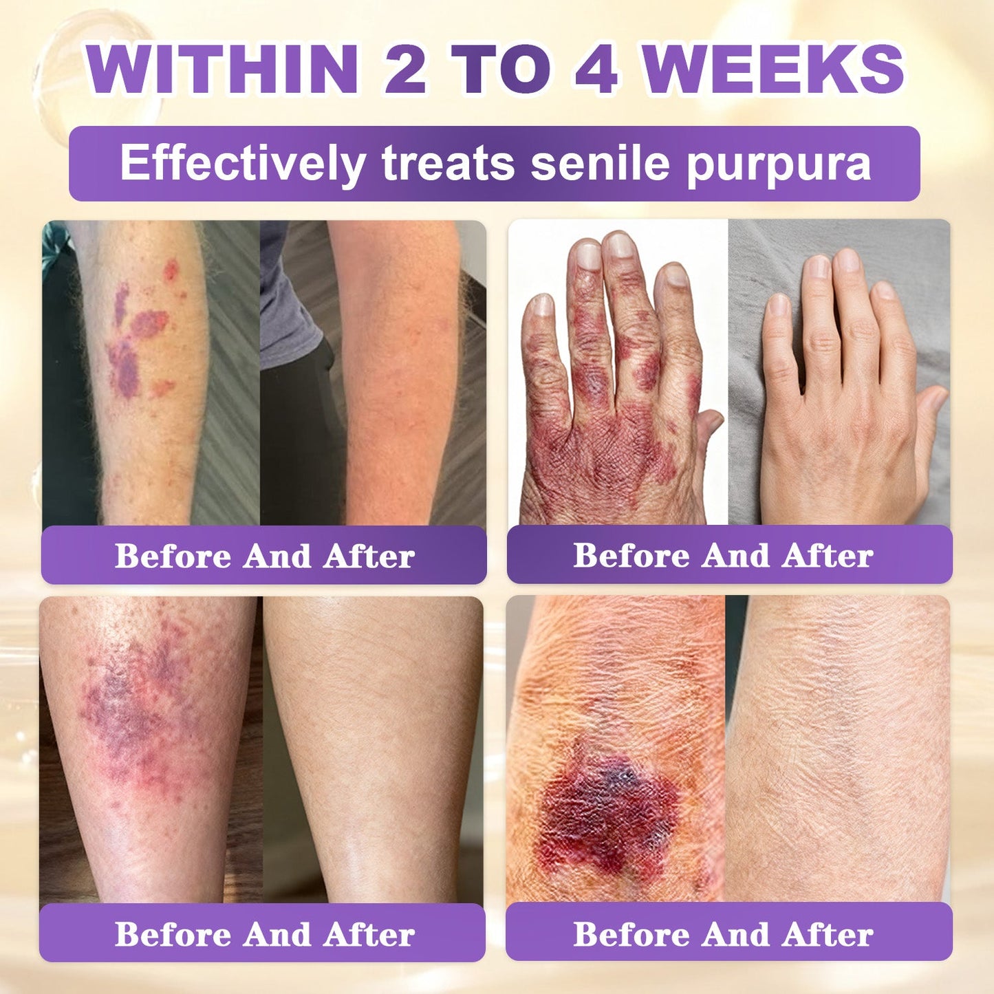 𝐆𝐎𝐋𝐃𝐊𝐈𝐒𝐒® --Only 10 jars! Grab an exclusive 30% discount now! Keep your skin youthful and glowing in just 1 to 3 weeks. Don’t miss your chance—this offer won’t come around again until next year. Act fast! 180-day money back guarantee!