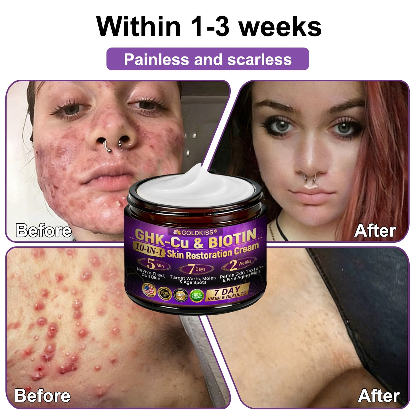 𝐆𝐎𝐋𝐃𝐊𝐈𝐒𝐒® --Only 10 jars! Grab an exclusive 30% discount now! Keep your skin youthful and glowing in just 1 to 3 weeks. Don’t miss your chance—this offer won’t come around again until next year. Act fast! 180-day money back guarantee!