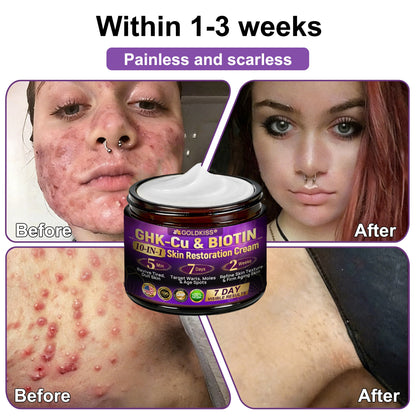 𝐆𝐎𝐋𝐃𝐊𝐈𝐒𝐒® --Only 10 jars! Grab an exclusive 30% discount now! Keep your skin youthful and glowing in just 1 to 3 weeks. Don’t miss your chance—this offer won’t come around again until next year. Act fast! 180-day money back guarantee!