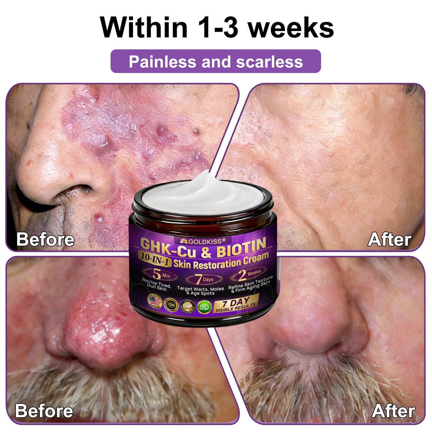 𝐆𝐎𝐋𝐃𝐊𝐈𝐒𝐒® --Only 10 jars! Grab an exclusive 30% discount now! Keep your skin youthful and glowing in just 1 to 3 weeks. Don’t miss your chance—this offer won’t come around again until next year. Act fast! 180-day money back guarantee!