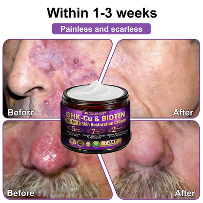 𝐆𝐎𝐋𝐃𝐊𝐈𝐒𝐒® --Only 10 jars! Grab an exclusive 30% discount now! Keep your skin youthful and glowing in just 1 to 3 weeks. Don’t miss your chance—this offer won’t come around again until next year. Act fast! 180-day money back guarantee!