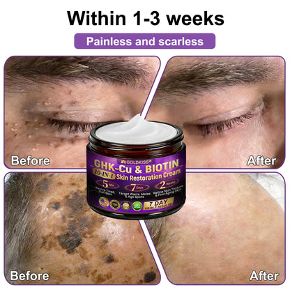 𝐆𝐎𝐋𝐃𝐊𝐈𝐒𝐒® --Only 10 jars! Grab an exclusive 30% discount now! Keep your skin youthful and glowing in just 1 to 3 weeks. Don’t miss your chance—this offer won’t come around again until next year. Act fast! 180-day money back guarantee!
