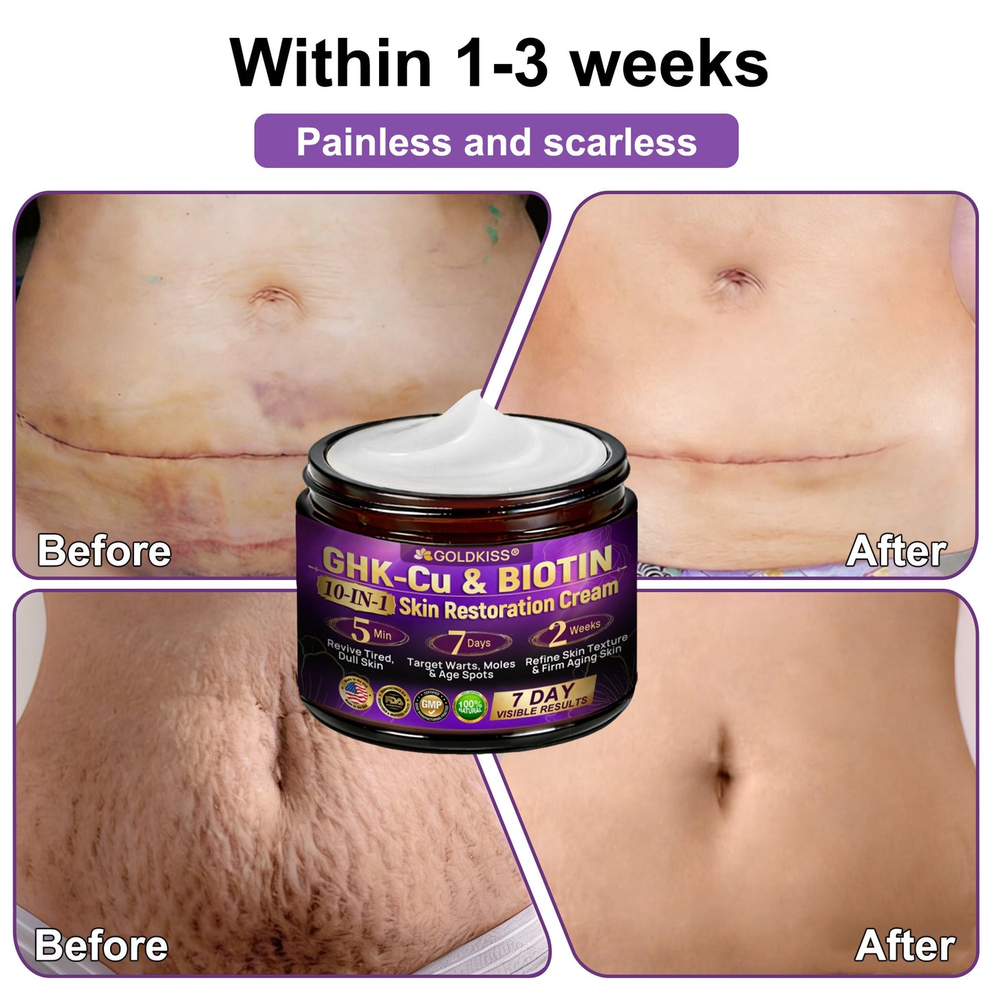 𝐆𝐎𝐋𝐃𝐊𝐈𝐒𝐒® --Only 10 jars! Grab an exclusive 30% discount now! Keep your skin youthful and glowing in just 1 to 3 weeks. Don’t miss your chance—this offer won’t come around again until next year. Act fast! 180-day money back guarantee!