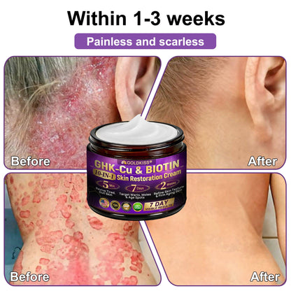 𝐆𝐎𝐋𝐃𝐊𝐈𝐒𝐒® --Only 10 jars! Grab an exclusive 30% discount now! Keep your skin youthful and glowing in just 1 to 3 weeks. Don’t miss your chance—this offer won’t come around again until next year. Act fast! 180-day money back guarantee!