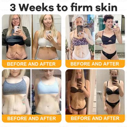 𝙑𝙇𝙎𝙑𝙇𝙎® 𝘽𝙀𝙀 𝙑𝙀𝙉𝙊𝙈 𝑺𝒌𝒊𝒏 𝑹𝒆𝒔𝒕𝒐𝒓𝒂𝒕𝒊𝒐𝒏 𝑪𝒓𝒆𝒂𝒎 –🌸 Anti-aging,Hydrating, Skin Repair, Even Tone, Acne and Dark Spot Treatment, Wart and Mole Removal, Psoriasis Relief
