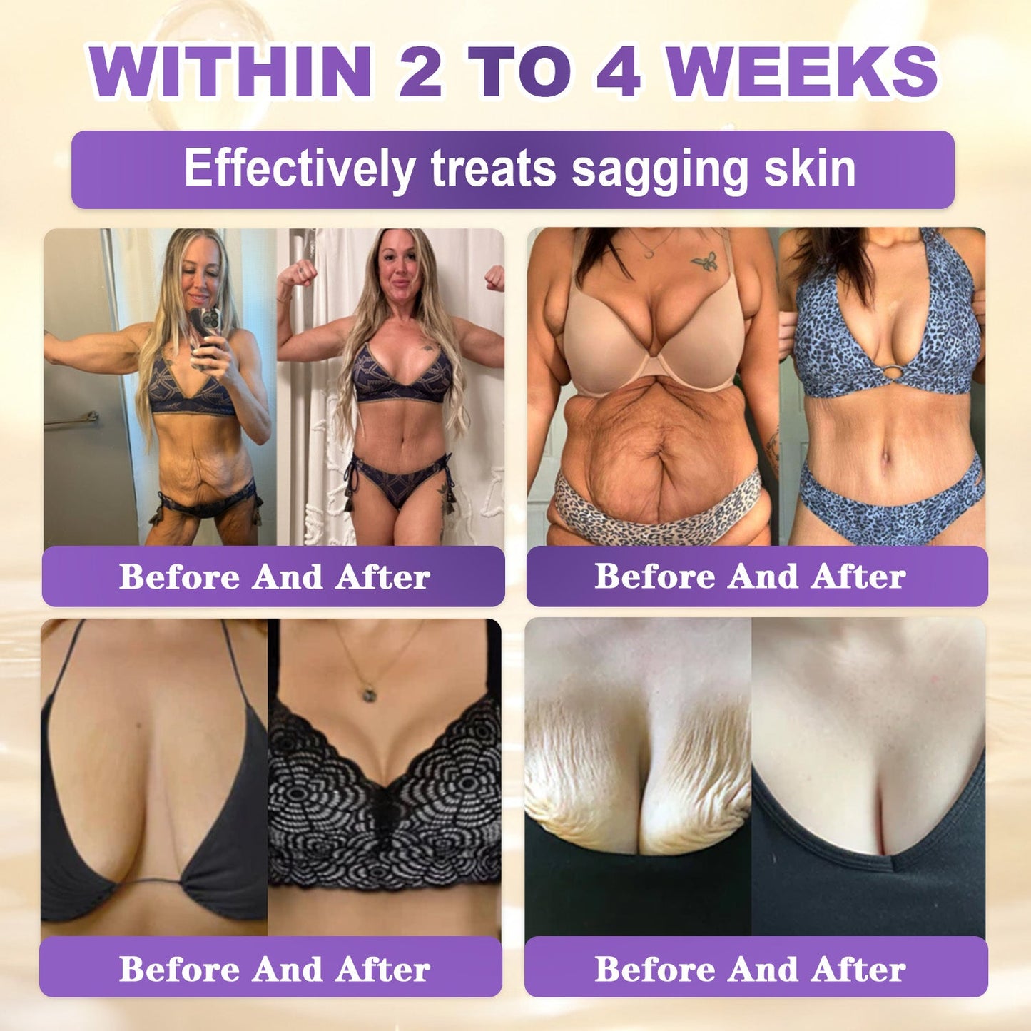 𝐆𝐎𝐋𝐃𝐊𝐈𝐒𝐒® --Only 10 jars! Grab an exclusive 30% discount now! Keep your skin youthful and glowing in just 1 to 3 weeks. Don’t miss your chance—this offer won’t come around again until next year. Act fast! 180-day money back guarantee!