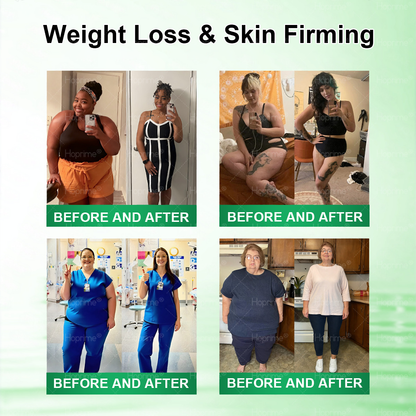 𝐏𝐡𝐲𝐬𝐢𝐜𝐢𝐚𝐧-𝐅𝐨𝐫𝐦𝐮𝐥𝐚𝐭𝐞𝐝 🧑‍⚕️| Hoprime® Moringa · Berberine × AMPK+ 10-in-1 Metabolic Support Nano Microneedle Patch — ✅ 𝐄𝐱𝐩𝐞𝐫𝐢𝐞𝐧𝐜𝐞 𝐕𝐢𝐬𝐢𝐛𝐥𝐞 𝟕-𝐃𝐚𝐲 𝐑𝐞𝐬𝐮𝐥𝐭𝐬 💐