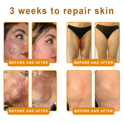 𝙑𝙇𝙎𝙑𝙇𝙎® 𝘽𝙀𝙀 𝙑𝙀𝙉𝙊𝙈 𝑺𝒌𝒊𝒏 𝑹𝒆𝒔𝒕𝒐𝒓𝒂𝒕𝒊𝒐𝒏 𝑪𝒓𝒆𝒂𝒎 –🌸 Anti-aging,Hydrating, Skin Repair, Even Tone, Acne and Dark Spot Treatment, Wart and Mole Removal, Psoriasis Relief