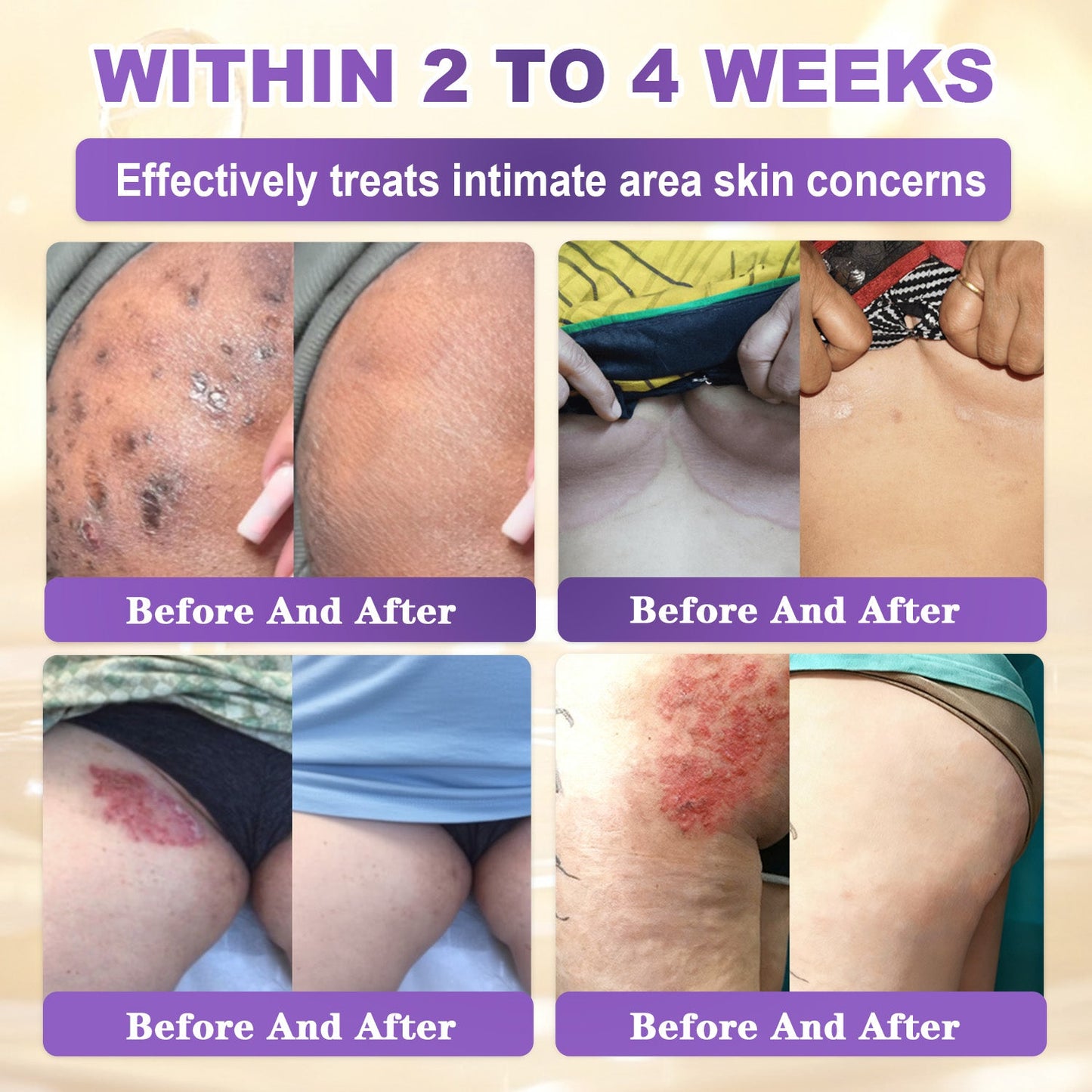 𝐆𝐎𝐋𝐃𝐊𝐈𝐒𝐒® --Only 10 jars! Grab an exclusive 30% discount now! Keep your skin youthful and glowing in just 1 to 3 weeks. Don’t miss your chance—this offer won’t come around again until next year. Act fast! 180-day money back guarantee!