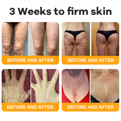 𝙑𝙇𝙎𝙑𝙇𝙎® 𝘽𝙀𝙀 𝙑𝙀𝙉𝙊𝙈 𝑺𝒌𝒊𝒏 𝑹𝒆𝒔𝒕𝒐𝒓𝒂𝒕𝒊𝒐𝒏 𝑪𝒓𝒆𝒂𝒎 –🌸 Anti-aging,Hydrating, Skin Repair, Even Tone, Acne and Dark Spot Treatment, Wart and Mole Removal, Psoriasis Relief