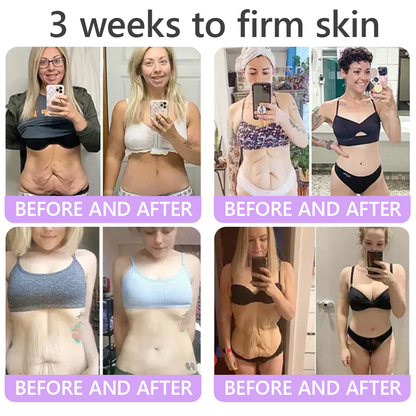 HISKIN® ---Only 10 boxes! Grab an exclusive 30% discount now! Keep your skin youthful and glowing in just 1 to 3 weeks. Don’t miss your chance—this offer won’t come around again until next year. Act fast! 180-day money back guarantee!🔥