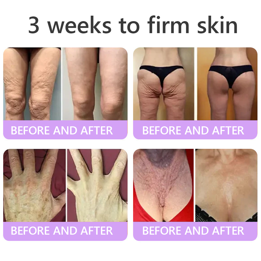 HISKIN® ---Only 10 boxes! Grab an exclusive 30% discount now! Keep your skin youthful and glowing in just 1 to 3 weeks. Don’t miss your chance—this offer won’t come around again until next year. Act fast! 180-day money back guarantee!🔥