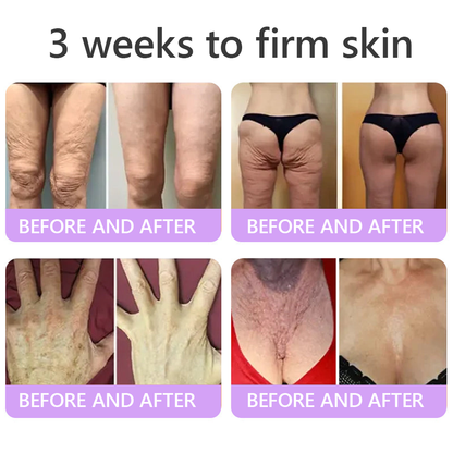 HISKIN® ---Only 10 boxes! Grab an exclusive 30% discount now! Keep your skin youthful and glowing in just 1 to 3 weeks. Don’t miss your chance—this offer won’t come around again until next year. Act fast! 180-day money back guarantee!🔥