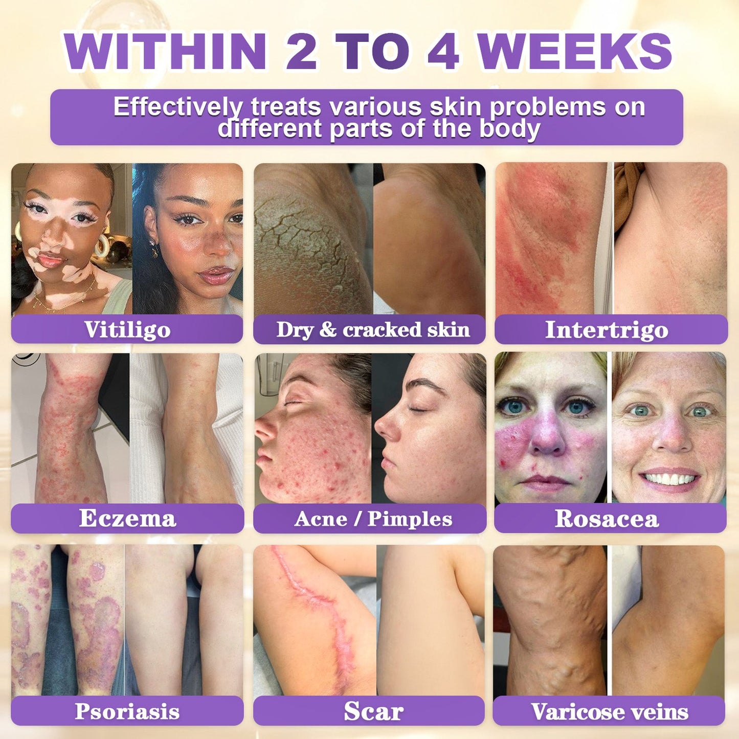 𝐆𝐎𝐋𝐃𝐊𝐈𝐒𝐒® --Only 10 jars! Grab an exclusive 30% discount now! Keep your skin youthful and glowing in just 1 to 3 weeks. Don’t miss your chance—this offer won’t come around again until next year. Act fast! 180-day money back guarantee!