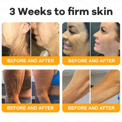 𝙑𝙇𝙎𝙑𝙇𝙎® 𝘽𝙀𝙀 𝙑𝙀𝙉𝙊𝙈 𝑺𝒌𝒊𝒏 𝑹𝒆𝒔𝒕𝒐𝒓𝒂𝒕𝒊𝒐𝒏 𝑪𝒓𝒆𝒂𝒎 –🌸 Anti-aging,Hydrating, Skin Repair, Even Tone, Acne and Dark Spot Treatment, Wart and Mole Removal, Psoriasis Relief