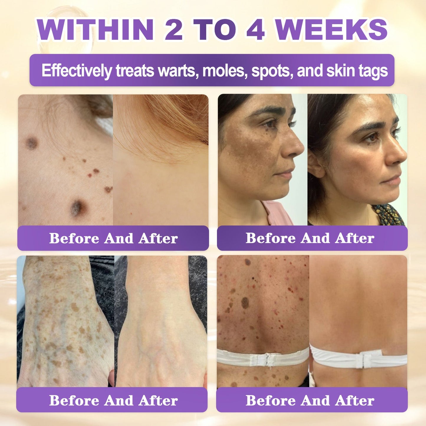𝐆𝐎𝐋𝐃𝐊𝐈𝐒𝐒® --Only 10 jars! Grab an exclusive 30% discount now! Keep your skin youthful and glowing in just 1 to 3 weeks. Don’t miss your chance—this offer won’t come around again until next year. Act fast! 180-day money back guarantee!