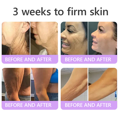 HISKIN® ---Only 10 boxes! Grab an exclusive 30% discount now! Keep your skin youthful and glowing in just 1 to 3 weeks. Don’t miss your chance—this offer won’t come around again until next year. Act fast! 180-day money back guarantee!🔥