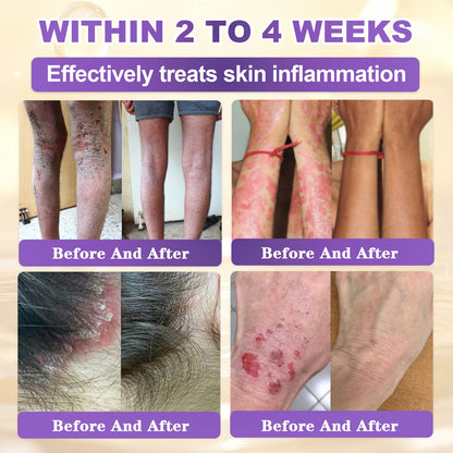 𝐆𝐎𝐋𝐃𝐊𝐈𝐒𝐒® --Only 10 jars! Grab an exclusive 30% discount now! Keep your skin youthful and glowing in just 1 to 3 weeks. Don’t miss your chance—this offer won’t come around again until next year. Act fast! 180-day money back guarantee!