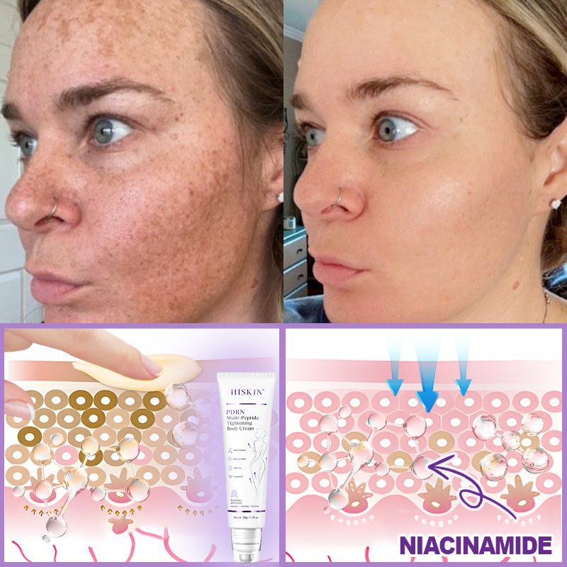HISKIN® ---Only 10 boxes! Grab an exclusive 30% discount now! Keep your skin youthful and glowing in just 1 to 3 weeks. Don’t miss your chance—this offer won’t come around again until next year. Act fast! 180-day money back guarantee!🔥
