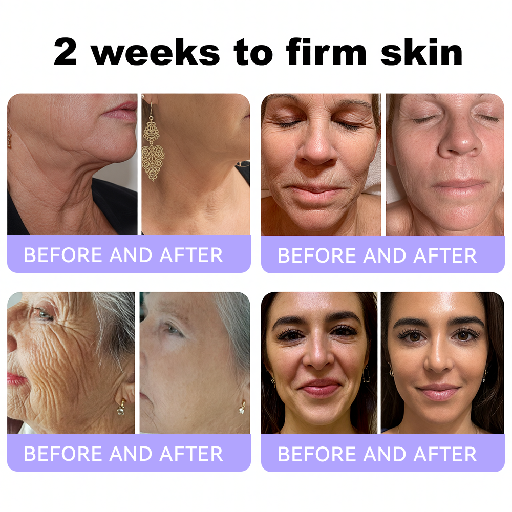 Himilk® Bee Venom & Botox Wrinkle-Lift Tightening Cream 🐝 (Anti-Aging,Hydration, Skin Repair, Acne & Dark Spot Treatment, Wart & Mole Removal, Psoriasis Relief) 🌸