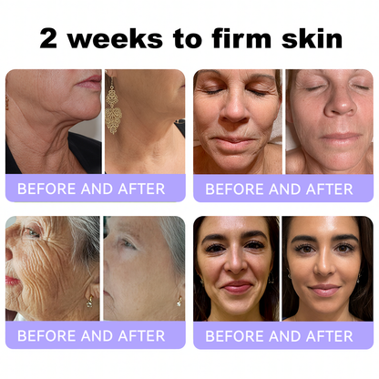 Himilk® Bee Venom & Botox Wrinkle-Lift Tightening Cream 🐝 (Anti-Aging,Hydration, Skin Repair, Acne & Dark Spot Treatment, Wart & Mole Removal, Psoriasis Relief) 🌸