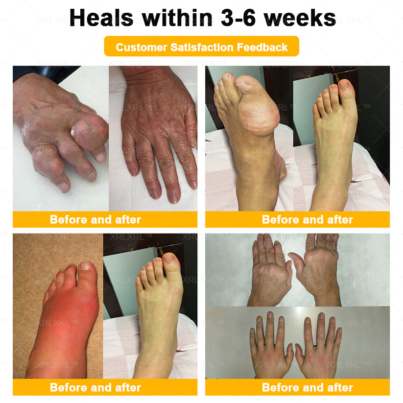 XRLXRL® Bee Venom Pain-Relief Bone Healing Cream ⏰(Specially for older adults)