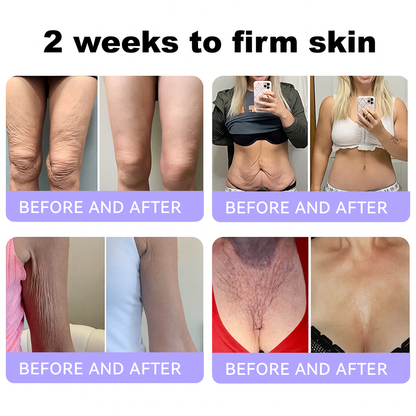 Himilk® Bee Venom & Botox Wrinkle-Lift Tightening Cream 🐝 (Anti-Aging,Hydration, Skin Repair, Acne & Dark Spot Treatment, Wart & Mole Removal, Psoriasis Relief) 🌸