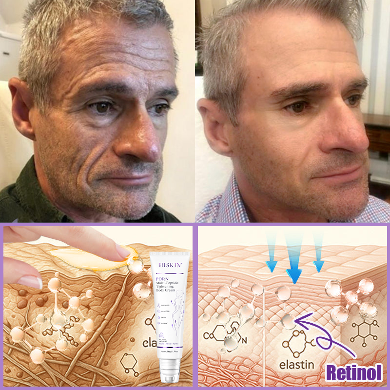 HISKIN® ---Only 10 boxes! Grab an exclusive 30% discount now! Keep your skin youthful and glowing in just 1 to 3 weeks. Don’t miss your chance—this offer won’t come around again until next year. Act fast! 180-day money back guarantee!🔥