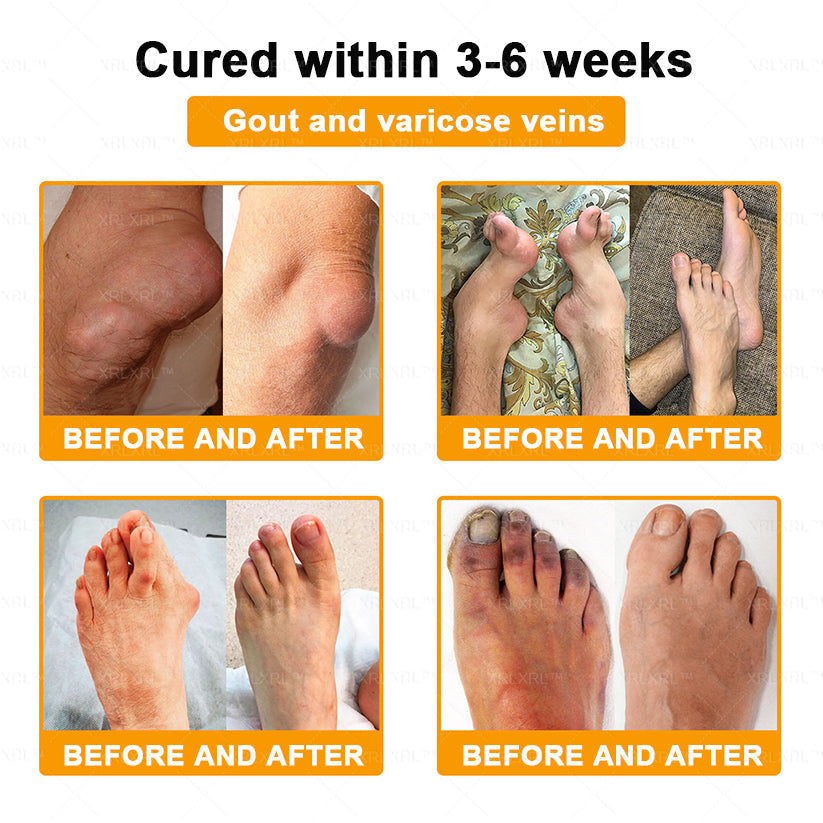 XRLXRL® Bee Venom Pain-Relief Bone Healing Cream ⏰(Specially for older adults)