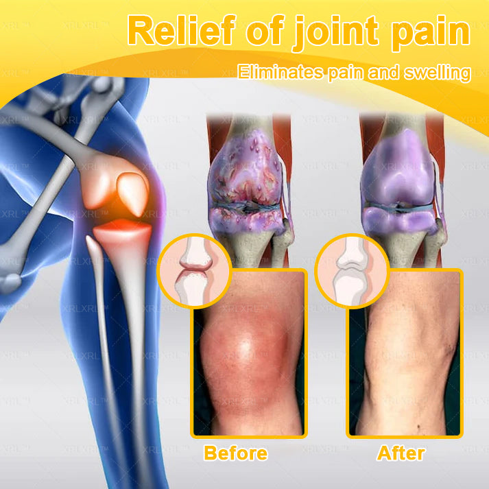 XRLXRL® Bee Venom Pain-Relief Bone Healing Cream ⏰(Specially for older adults)